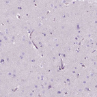 Immunohistochemical staining of human cerebral cortex shows no positivity in neurons as expected.