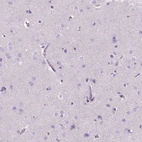 Immunohistochemical staining of human cerebral cortex shows no positivity in neurons as expected.