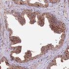Immunohistochemical staining of human prostate shows strong cytoplasmic granular positivity in glandular cells.