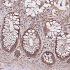 Immunohistochemical staining of human rectum shows moderate cytoplasmic positivity in glandular cells.