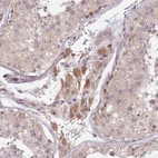 Immunohistochemical staining of human testis shows moderate cytoplasmic positivity in Leydig cells.