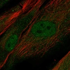 Immunofluorescent staining of human cell line BJ shows localization to nucleus & cytosol.