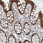 Immunohistochemical staining of human colon shows strong cytoplasmic-nucleus positivity in glandular cells and nucleus positivity in lymphoid cells,