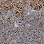 Immunohistochemical staining of human tonsil shows strong nuclear positivity in non-germinal center cells and cytoplasmic-nucleus positivity in squamous epithelial cells.