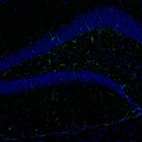 Immunofluorescence staining of mouse brain shows positivity in astrocytes in the hippocampus.