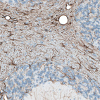 Immunohistochemical staining of mouse cerebellum shows positivity in astrocytes.