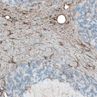 Immunohistochemical staining of mouse cerebellum shows positivity in astrocytes.