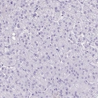 Immunohistochemical staining of human liver shows no positivity in hepatocytes as expected.
