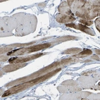 Immunohistochemical staining of human skeletal muscle shows strong cytoplasmic positivity in myocytes.