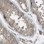 Immunohistochemical staining of human testis shows moderate cytoplasmic positivity in cells in seminiferous ducts and leydig cells.