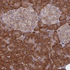 Immunohistochemical staining of human pancreas shows strong cytoplasmic/ cytoplasmic membranous positivity in exocrine glandular cells and weak cytoplasmic positivity in endocrine glandular cells.