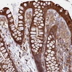 Immunohistochemical staining of human colon shows strong cytoplasmic/cytoplasmic membranous positivity in glandular cells.