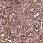 Immunohistochemical staining of human kidney shows moderate cytoplasmic positivity in cells in tubules.