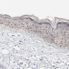 Immunohistochemical staining of human skin shows weak cytoplasmic positivity in squamous epithelial cells.