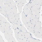 Immunohistochemical staining of human skeletal muscle shows no positivity in myocytes as expected.
