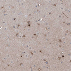 Immunohistochemical staining of human cerebral cortex shows moderate nuclear/ cytoplasmic positivity in glial cells.