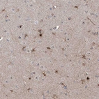 Immunohistochemical staining of human cerebral cortex shows moderate nuclear/ cytoplasmic positivity in glial cells.