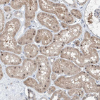 Immunohistochemical staining of human kidney shows strong nuclear positivity in a subset of cells in tubules.