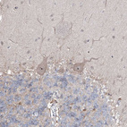 Immunohistochemical staining of human cerebellum shows strong nuclear positivity in Purkinje cells.