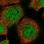 Immunofluorescent staining of human cell line A-431 shows localization to nucleoplasm & cytosol.