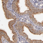 Immunohistochemical staining of human fallopian tube shows strong cytoplasmic positivity in glandular cells.