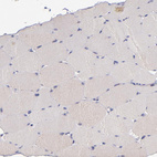 Anti-SHC1 Antibody