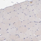 Immunohistochemical staining of human skeletal muscle shows no cytoplasmic positivity in myocytes as expected.