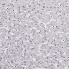 Immunohistochemical staining of human liver shows no positivity in hepatocytes as expected.