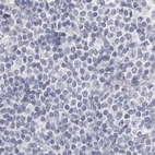 Immunohistochemical staining of human lymph node using Anti-CA6 antibody HPA028550.