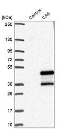 Western blot analysis in control (vector only transfected HEK293T lysate) and CA6 over-expression lysate (Co-expressed with a C-terminal myc-DDK tag (~3.1 kDa) in mammalian HEK293T cells, LY420071).