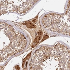 Immunohistochemical staining of human testis shows strong cytoplasmic and nuclear positivity in Leydig cells.