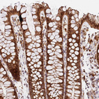 Immunohistochemical staining of human colon shows strong cytoplasmic positivity in glandular cells.