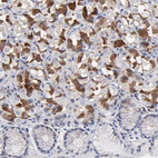 Immunohistochemical staining of human stomach shows strong cytoplasmic positivity in glandular cells.