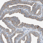 Immunohistochemical staining of human fallopian tube shows strong cytoplasmic granular positivity in glandular cells.