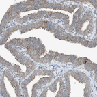 Immunohistochemical staining of human fallopian tube shows strong cytoplasmic granular positivity in glandular cells.