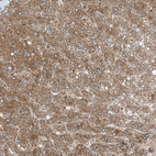Immunohistochemical staining of human liver shows strong cytoplasmic granular positivity in hepatocytes.