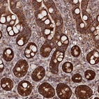 Immunohistochemical staining of human duodenum shows strong cytoplasmic-membranous positivity in glandular cells.