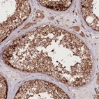 Immunohistochemical staining of human testis shows strong cytoplasmic-membranous positivity in cells in seminiferous ducts.