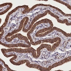 Immunohistochemical staining of human fallopian tube shows strong cytoplasmic-membranous positivity in glandular cells.