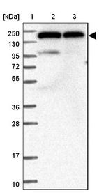 Lane 1: Marker [kDa] 250, 130, 95, 72, 55, 36, 28, 17, 10_br/_Lane 2: Human cell line RT-4_br/_Lane 3: Human cell line U-251MG sp