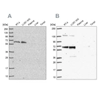 Western blot analysis using Anti-PUF60 antibody HPA052096 (A) shows similar pattern to independent antibody HPA059714 (B).
