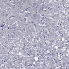 Immunohistochemical staining of human liver shows no positivity in hepatocytes as expected.