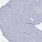 Immunohistochemical staining of human skeletal muscle shows no positivity in myocytes as expected.