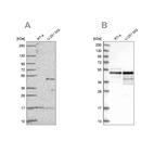 Western blot analysis using Anti-TFAP2A antibody HPA056871 (A) shows similar pattern to independent antibody HPA028850 (B).