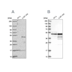 Western blot analysis using Anti-TFAP2A antibody HPA056871 (A) shows similar pattern to independent antibody HPA028850 (B).