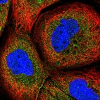 Anti-CPTP Antibody