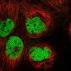 Anti-HIVEP3 Antibody