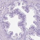 Immunohistochemical staining of human prostate shows no positivity in glandular cells as expected.