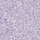 Immunohistochemical staining of human liver shows no positivity in hepatocytes as expected.