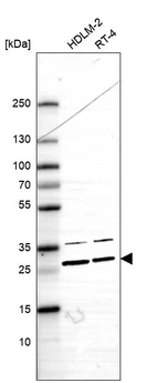 Western blot analysis in human cell line HDLM-2 and human cell line RT-4.